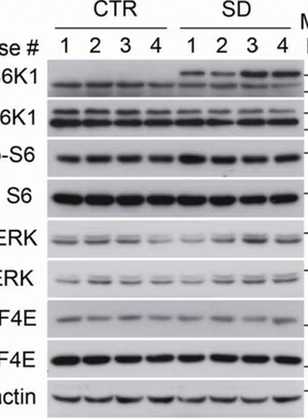 wb做wb趋势定制WB/western blot/免疫印迹条带/wb条带整膜/定制