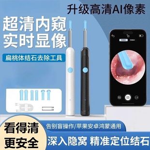 扁桃体结石挖勺清洁清理神器口腔隐窝取出勺子可视扁导体异物掏取