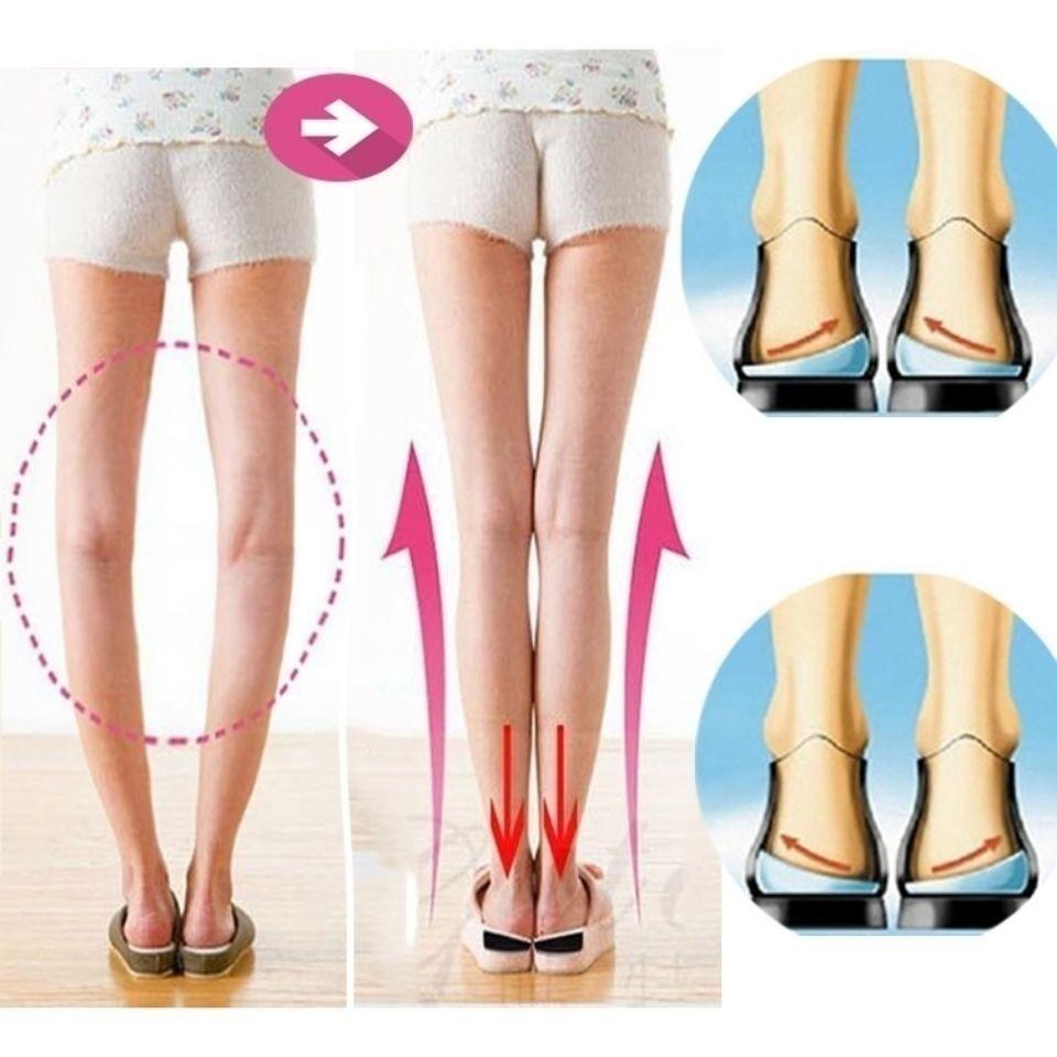 鞋垫宝宝膜炎男女矫正足弓学生型