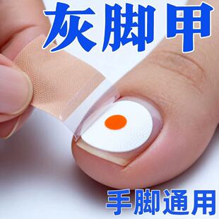 灰趾增厚正品 专用灰指贴发黄粉碎甲脚趾手指甲专用 香港断货王