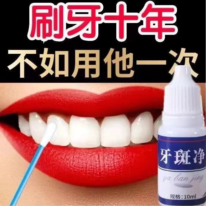 洁牙粉牙齿美白速效去黄牙黑斑去烟渍洗牙污垢茶渍牙菌斑祛除神器