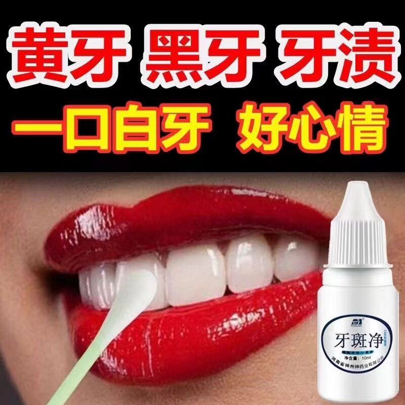 洁牙粉牙齿美白速效去黄牙黑斑去烟渍洗牙污垢茶渍牙菌斑祛除神器