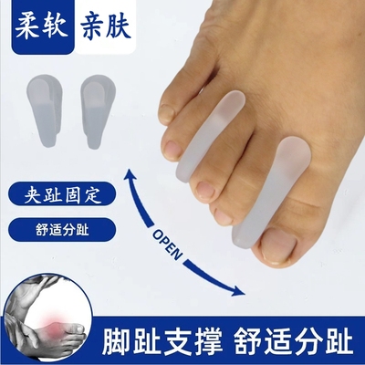 A字型分趾器脚趾重叠分离器