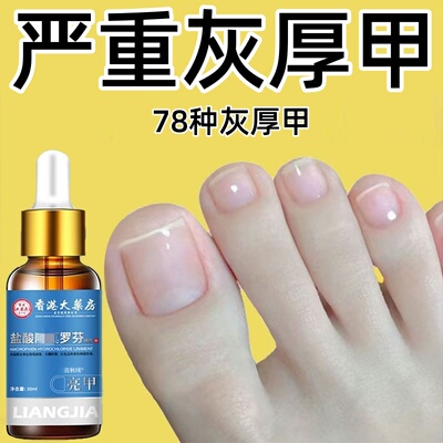 灰指甲阿莫罗凤仙花芬搽剂抑菌液日本进口药一滴净药水正品