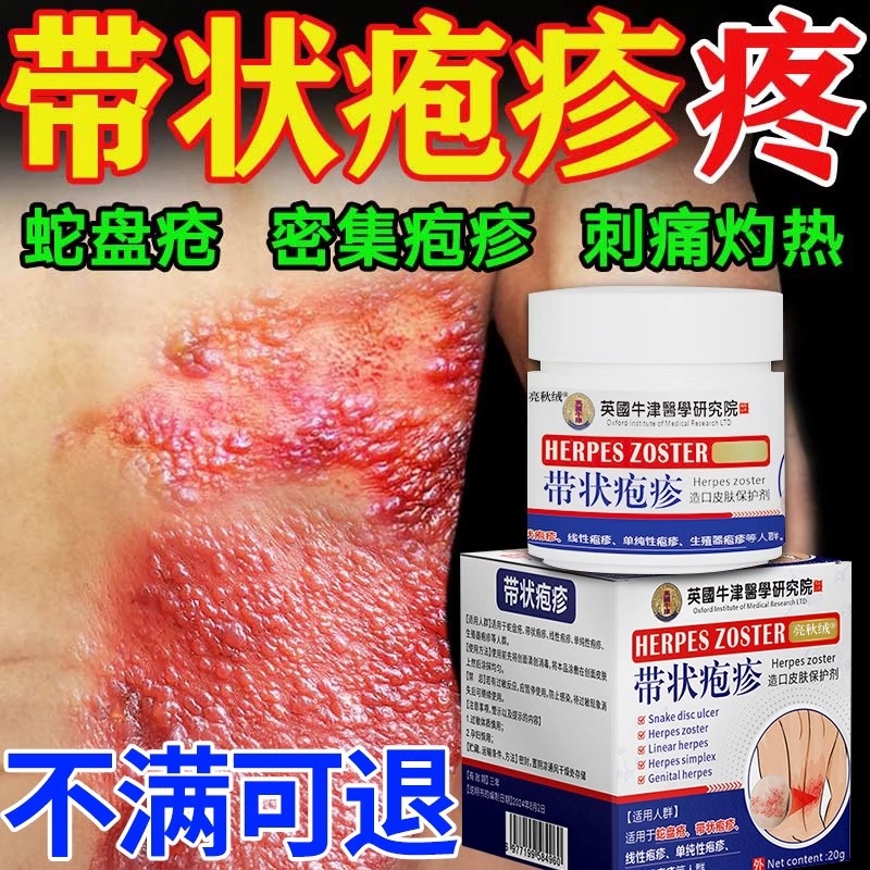 【待校药】带状疱疹特用膏