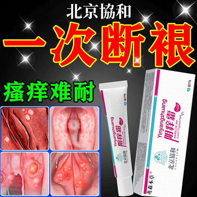 外阴瘙痒妇科非去女性私处止痒根专用痒非膏药抑菌膏非药膏