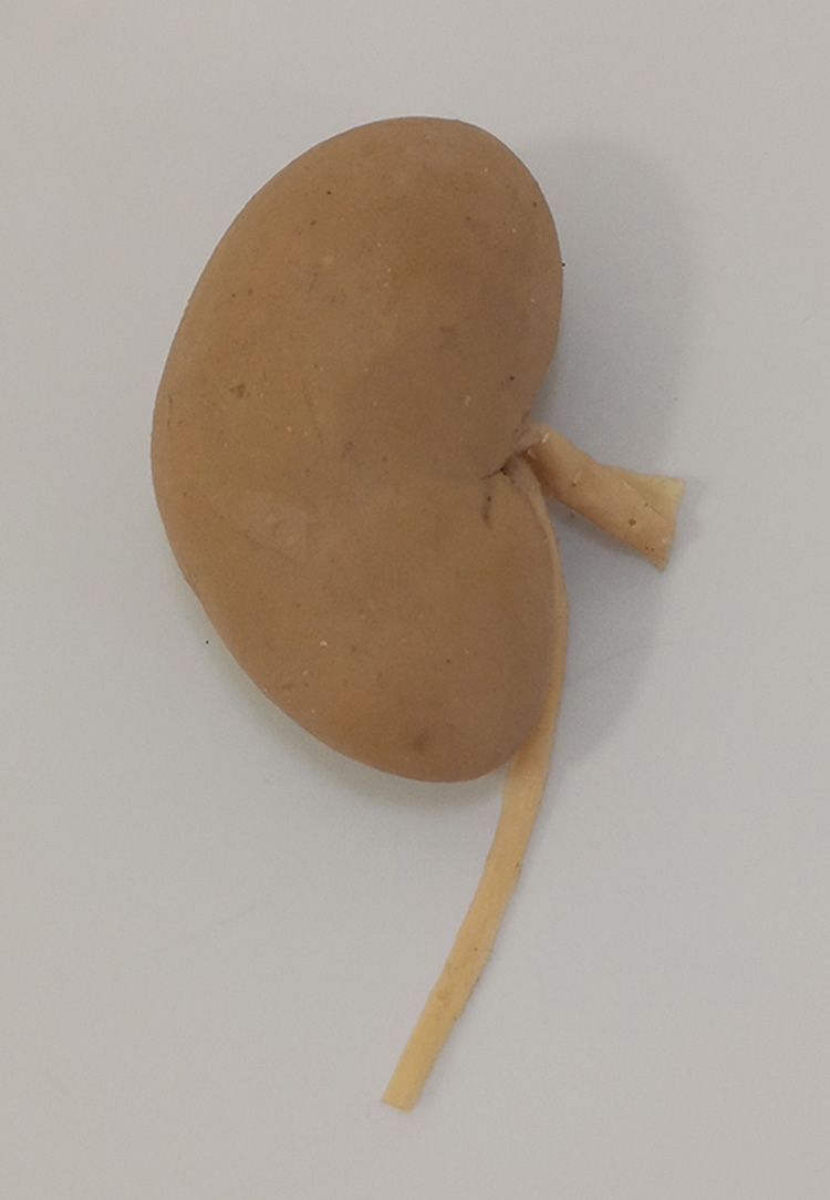 犬单肾狗肾外形塑化标本   实物模型,精细细节,教学演示,宠医