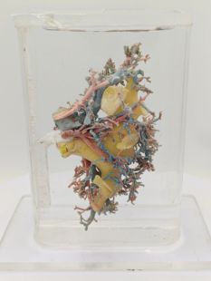 猪肾动静脉肾盂管道（疏）铸型科普陈列生物课动物医学实验教学