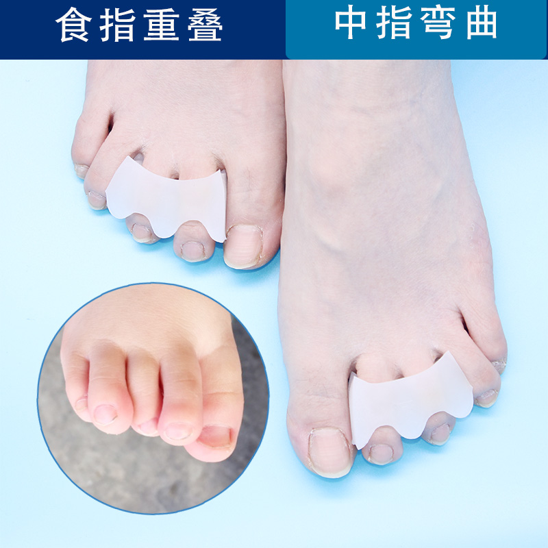 中指食指重叠弯曲脚趾矫正器爪状趾矫正大拇指外翻矫正纠正日夜用