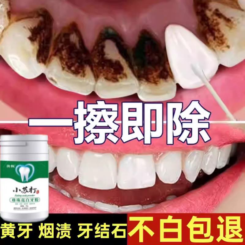 牙结石去除器溶解牙石速效清理工具黄牙黑烟渍牙垢牙菌斑洗牙神器