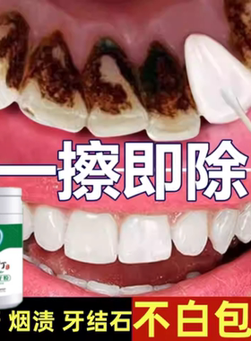 牙结石去除器溶解牙石速效清理工具黄牙黑烟渍牙垢牙菌斑洗牙神器