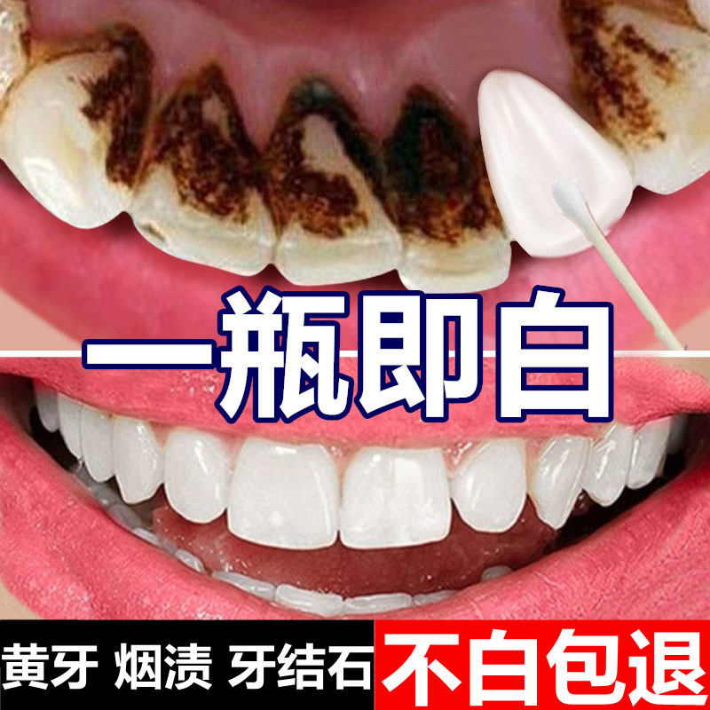 强力去烟渍牙膏美白牙齿速效去除牙膏