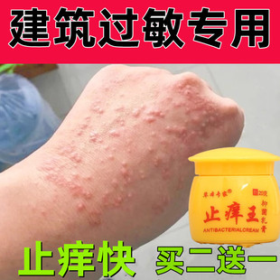 过敏止痒专用非药治水泥过敏手上起小水泡手痒脱皮干裂止痒膏