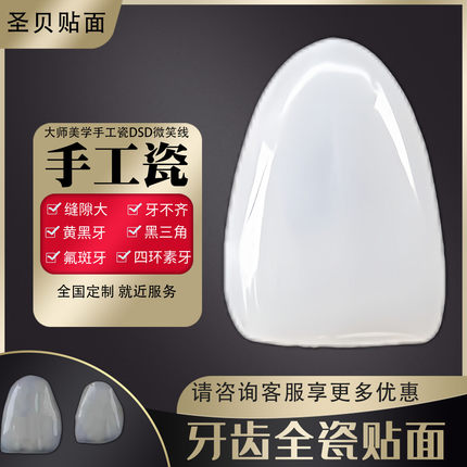 瓷大师美学手工瓷进口义获嘉璀璨瓷全瓷牙齿贴片牙贴面全瓷贴片