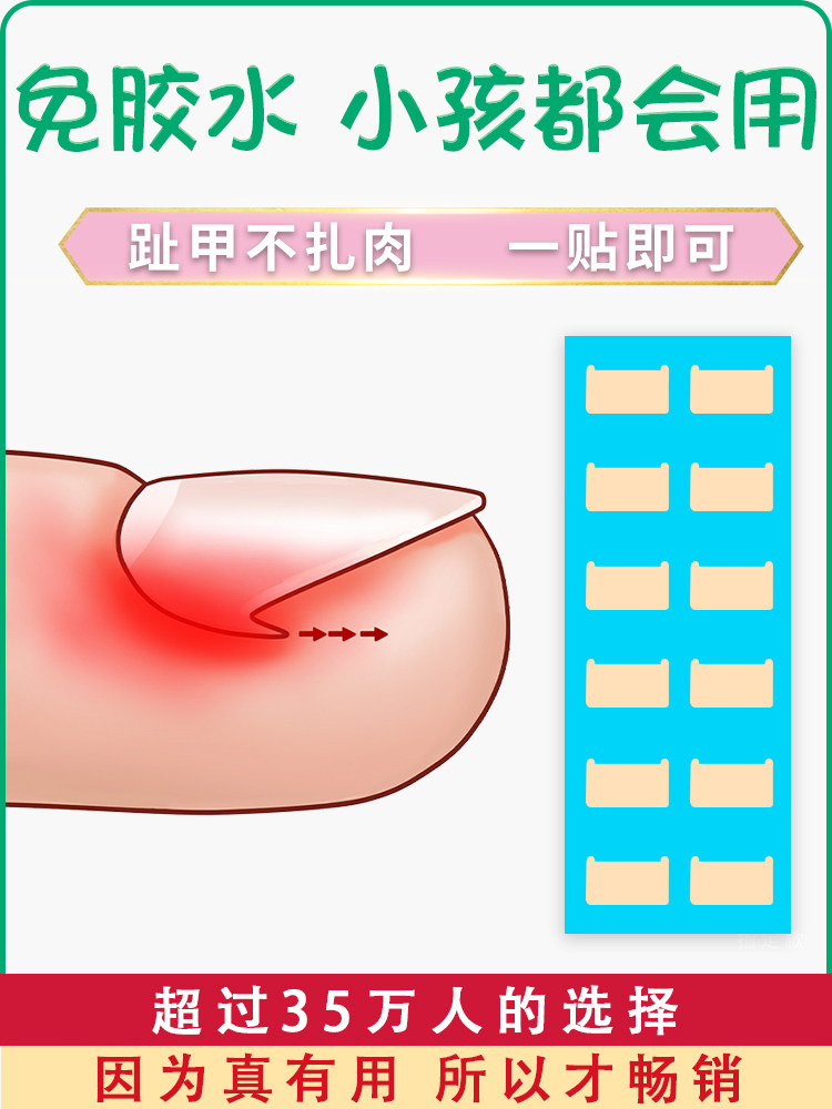 손톱 홈 교정 패치 내생발톱 패치 손톱 버클 발톱 패치 긴살 인공물 손톱 컬 염증 복구 및 교정