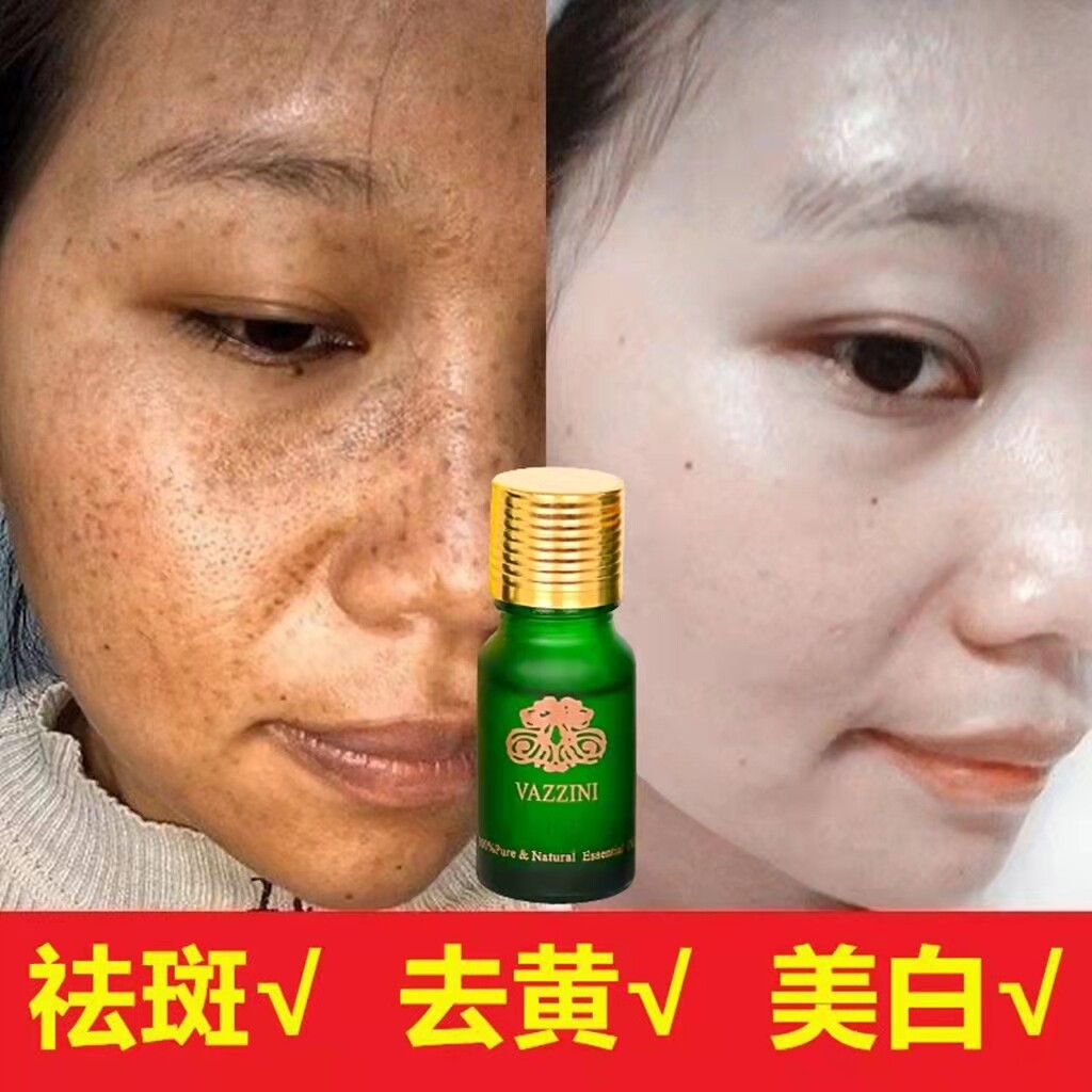 Vazzini淡斑美白发光提亮精油