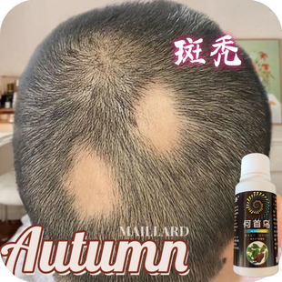脱发严重男女士专用防脱洗发水生发中药增发密发斑秃鬼剃头生发液