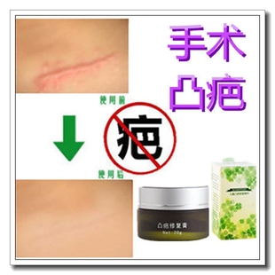祛刀疤修复膏消除儿童烟疤痕遮盖贴敷料红印去增生肉疙瘩软化缝针
