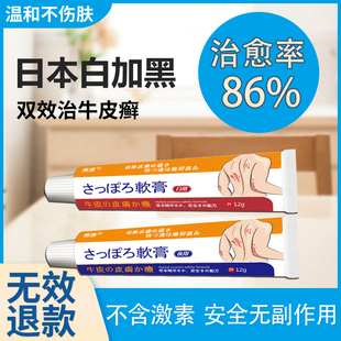 牛皮專(zhuān)用癬治濕疹皮膚瘙癢外用銀特效止癢屑病中軟藥膏進(jìn)口配方GP