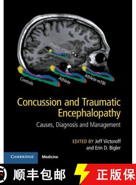 【3-4周达】Concussion and Traumatic Encephalopathy: Causes, Diagnosis and Management [9781107073951]