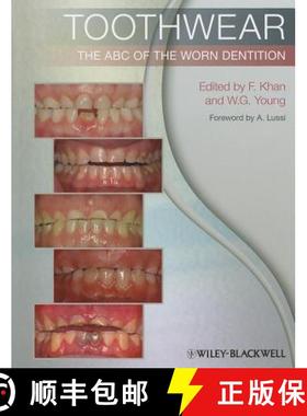 【3-4周达】Toothwear - The Abc Of The Worn Dentition [Wiley牙科医学] [9781444336559]