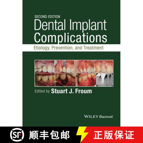 【3-4周达】精装 Dental Implant Complications: Etiology, Prevention, And Treatment, Second Edition [Wi... [9781118976456]