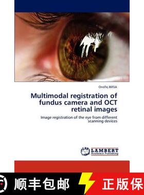预订 Multimodal registration of fundus camera and OCT retinal images [9783659228773]