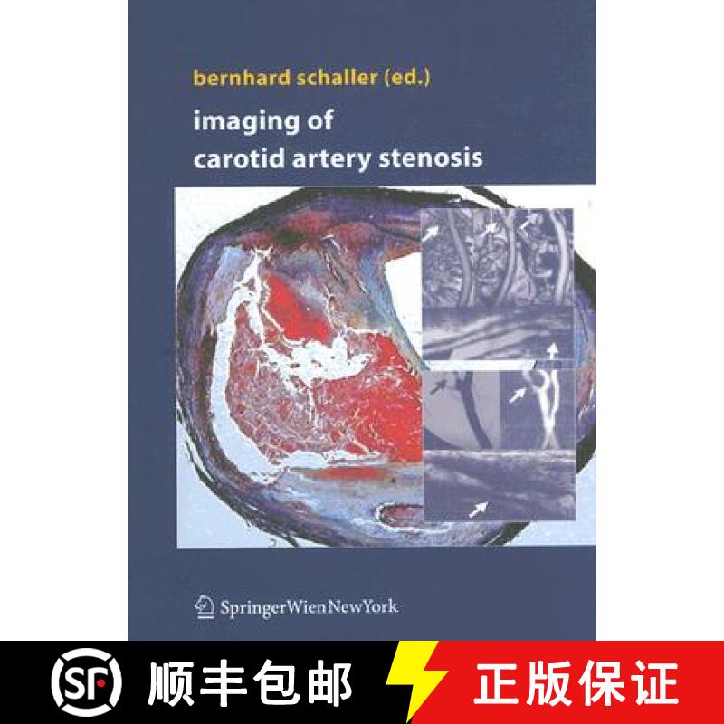 【3-4周达】Imaging of Carotid Artery Stenosis [9783211323328]