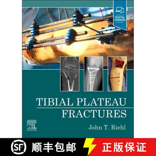 【3-4周达】精装 Tibial Plateau Fractures [9780323825689]