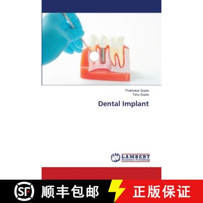 预订 Dental Implant [9786202565769]