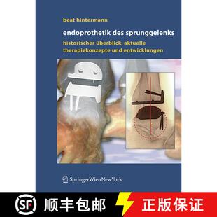 【3-4周达】Endoprothetik des Sprunggelenks: Historischer Überblick, aktuelle Therapiekonzepte und En... [9783211235867]