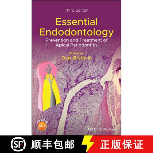 【3-4周达】精装 Essential Endodontology - Prevention And Treatmentof Apical Periodontitis, 3Rd Editio... [9781119271956]