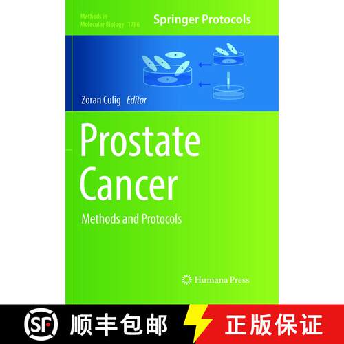 【3-4周达】Prostate Cancer: Methods and Protocols [9781493993024]