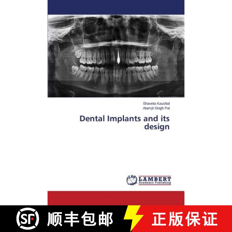 【3-4周达】Dental Implants and Its Design [9783659592294]