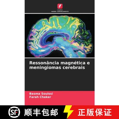 【3-4周达】Ressonância magnética e meningiomas cerebrais (Aufl.) [9786208986971]