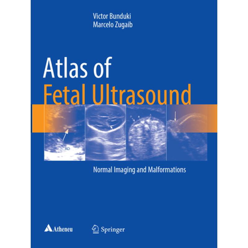 【4周达】Atlas of Fetal Ultrasound: Normal Imaging and Malformations [9783319854854] 书籍/杂志/报纸 科学技术类原版书 原图主图