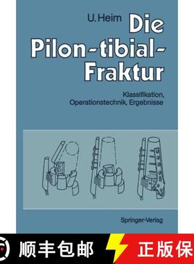 【3-4周达】Die Pilon-Tibial-Fraktur: Klassifikation, Operationstechnik, Ergebnisse [9783642759604]