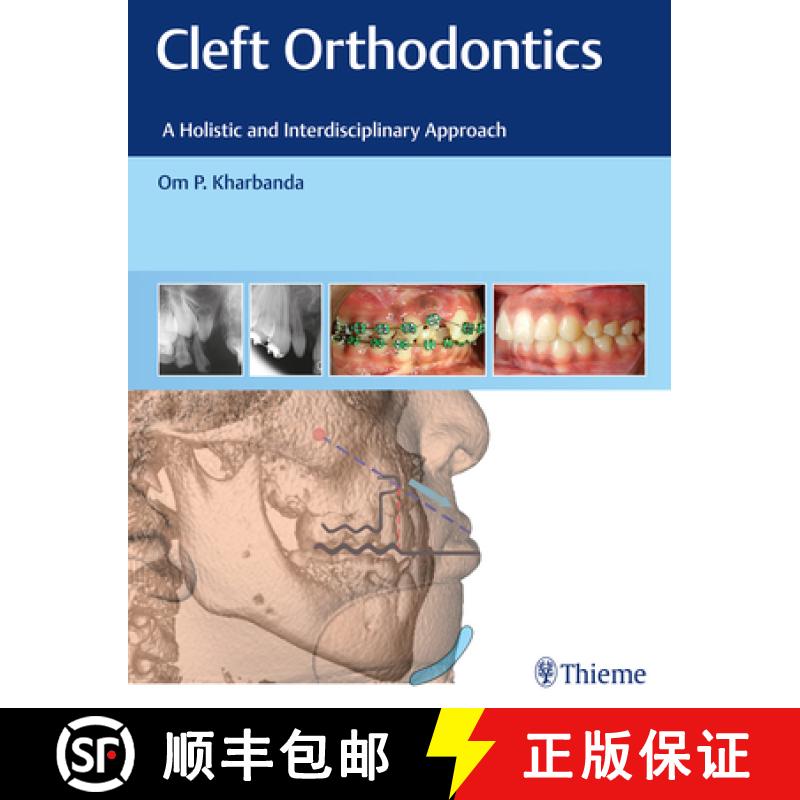 【3-4周达】Cleft Orthodontics: A Holistic and Interdisciplinary Approach [9788194857082]