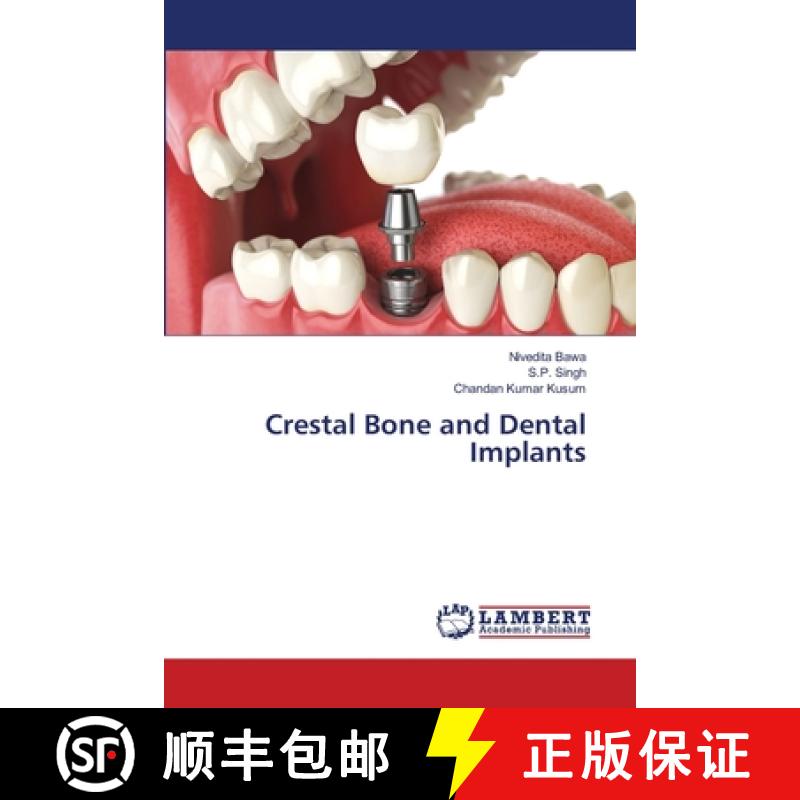 预订 Crestal Bone and Dental Implants [9786139577293]