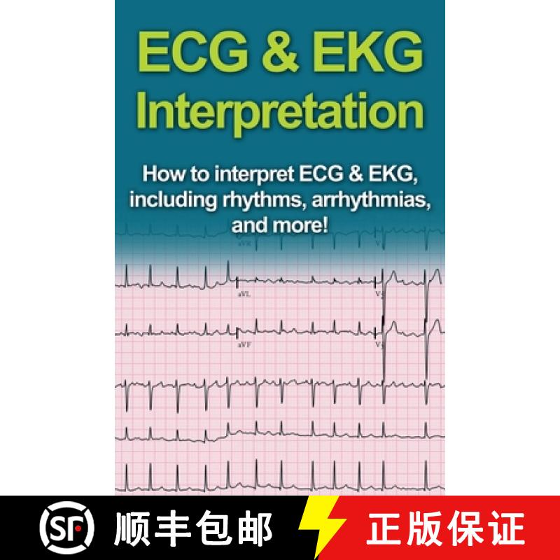 【3-4周达】ECG & EKG Interpretation: How to interpret ECG & EKG, including rhythms, arrhythmias, and ... [9781761030987]
