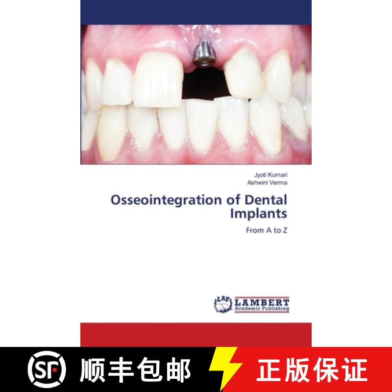 【2-3周达】Osseointegration of Dental Implants [9786205640739]