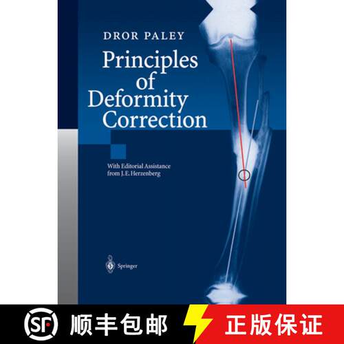 【3-4周达】Principles of Deformity Correction [9783642639531]
