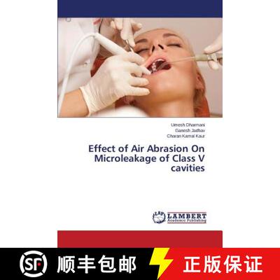 预订 Effect of Air Abrasion On Microleakage of Class V cavities [9783659625374]