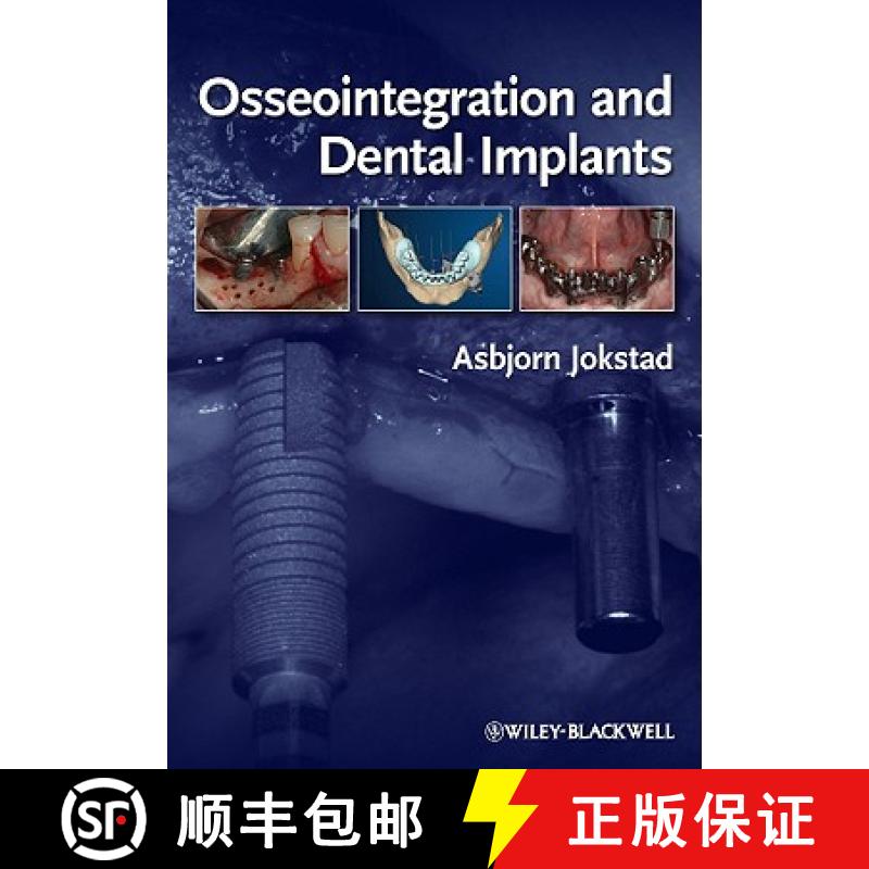 【3-4周达】Osseointegration And Dental Implants [Wiley牙科医学] [9780813813417]