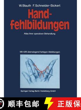 【3-4周达】Handfehlbildungen: Atlas Ihrer Operativen Behandlung [9783662119891]