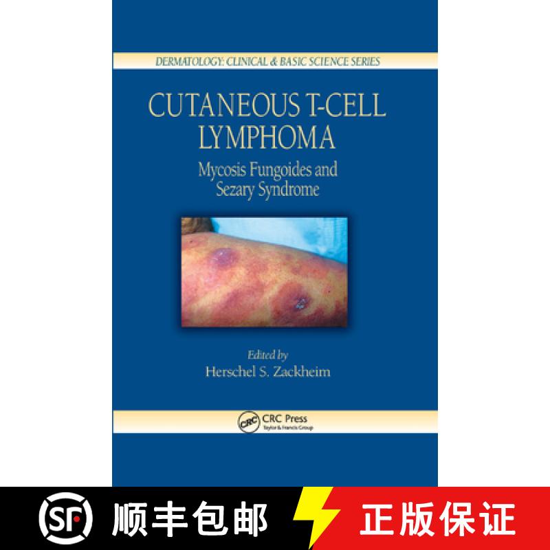 【3-4周达】Cutaneous T-Cell Lymphoma: Mycosis Fungoides and Sezary Syndrome [9780367393670]