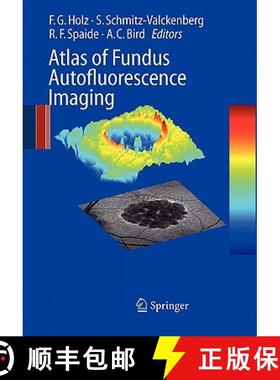 【3-4周达】Atlas of Fundus Autofluorescence Imaging [9783642091193]