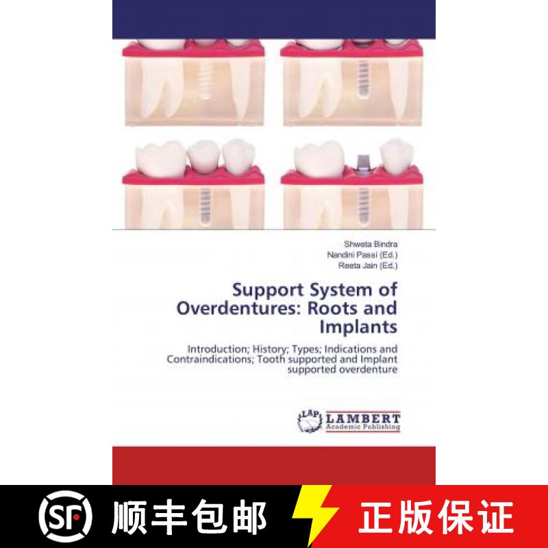 预订 Support System of Overdentures: Roots and Implants [9786200247636]