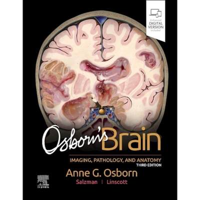 【4周达】Osborn's Brain [9780443109379]