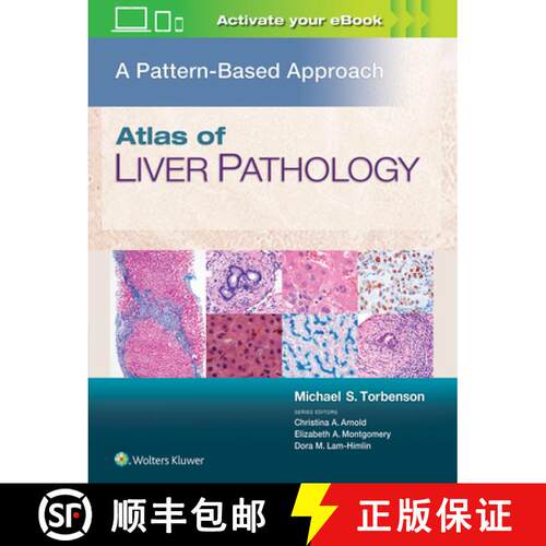 【3-4周达】精装 Atlas of Liver Pathology: A Pattern-Based Approach [9781496396976]